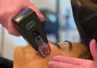Can Morpheus8 Deliver Noticeable After Results?