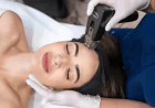 Can Morpheus8 Help Bring Back Your Skin’s Radiance?