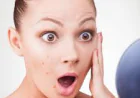 How Modern Acne Removal in Dubai Helps You Achieve Smoother and Healthier-Looking Skin