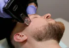 Is Morpheus8 Therapy Suitable for Every Skin Type?