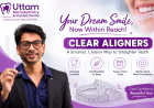 How to Care for Your Clear Aligners for Faster and Better Results
