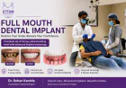Full Mouth Dental Implants Cost: A Complete Guide for Patients