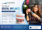 Full Mouth Dental Implants Cost: 7 Factors That Influence Your Treatment Plan