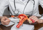 Cystolithotripsy Surgery in Gurgaon: Advanced Treatment for Bladder Stones