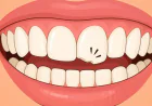 Cosmetic Dentistry in Bryn Mawr | Dillon Family Dentistry