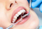 Why Your Teeth Age Faster Than You Do in a Busy Pune Neighbourhood?