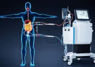 What is HIPEC Surgery? Procedure, Benefits, Risks, and Recovery