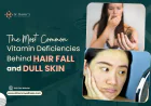 The Most Common Vitamin Deficiencies Behind Hair Fall and Dull Skin