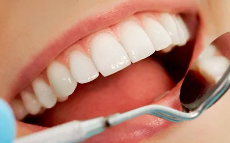 Dental Implants in Dubai vs Dental Bridges