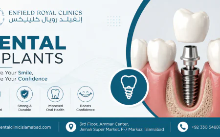 Dental Implants Are the Best Long-Term Solution for Missing Teeth: