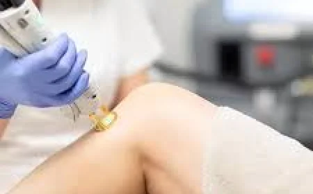 Laser Hair Removal in Dubai Aftercare: Essential Tips for Smooth and Healthy Skin