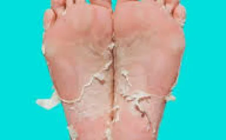 Leg Peel in Dubai for Smooth and Healthy-Looking Legs | Skin Renewal Guide