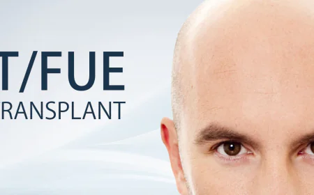 Recovery Tips After Hair Transplant For Week One?