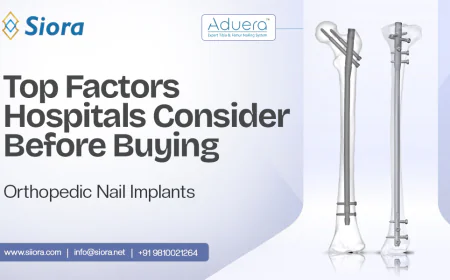 Top Factors Hospitals Consider Before Buying Orthopedic Nail Implants