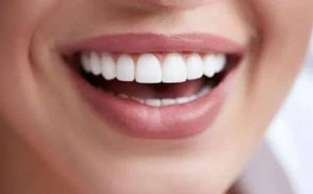 Brighten Your Smile Naturally with Zoom Teeth Whitening in Dubai | Complete Guide