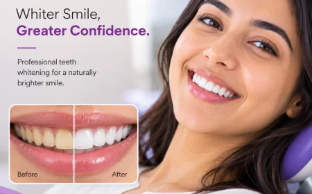 Why Do Teeth Become Stained Again After Whitening?