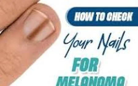 How to Inspect Nails for Melanoma Cancer