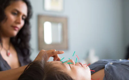 Facial Acupuncture for Acne & Rosacea in Oakland