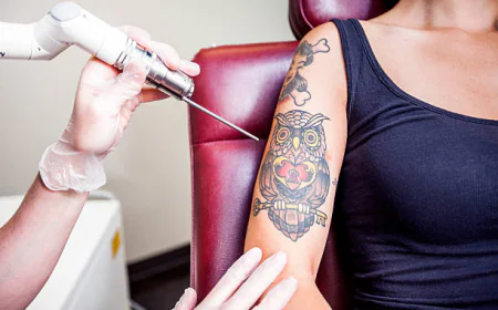 Can Laser Tattoo Removal Remove All Ink Colors
