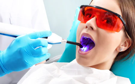 What Are Dental Sealants and How Do They Prevent Cavities?