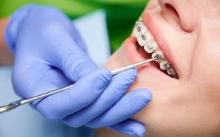 Orthodontics in Dubai: How Modern Treatments Help Create a Perfect Smile