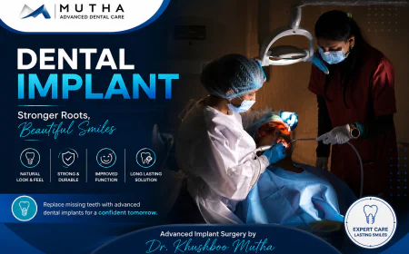 Dental Implant: How the Procedure Works Step by Step