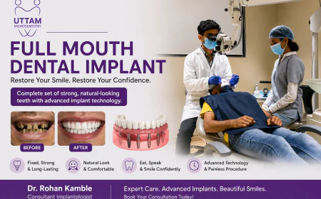 Full Mouth Dental Implants Cost: A Complete Guide for Patients