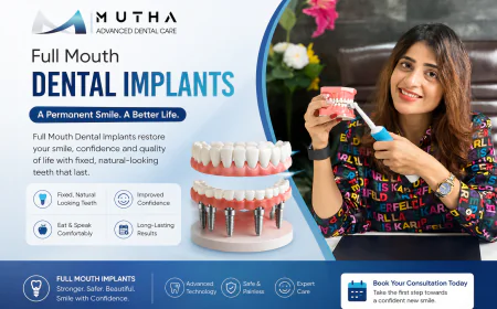 Full Mouth Dental Implants Cost: 7 Factors That Influence Your Treatment Plan