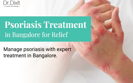 Psoriasis on the Scalp: Symptoms, Causes and Treatment Options