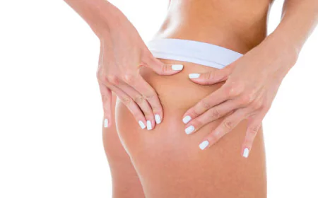 Can French Butt Reshaping Improve Body Balance?