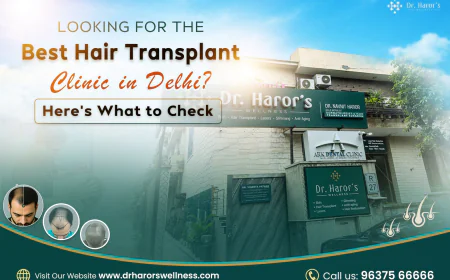 Looking for the Best Hair Transplant Clinic in Delhi? Here’s What to Check