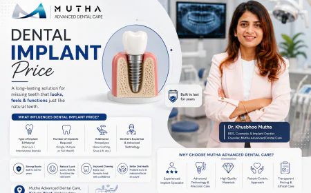 Teeth Implants Price: What You Should Know Before Choosing Dental Implants