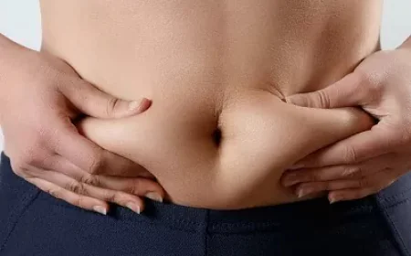 Liposuction Surgery in Dubai: Is It the Right Choice for Your Body Contouring Goals
