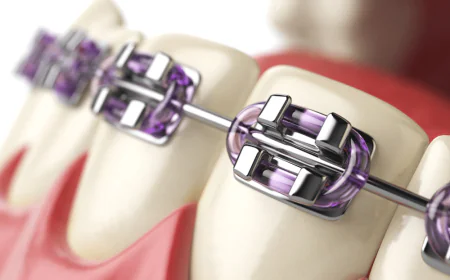 Affordable Orthodontics and Dental Implants Near Me: Your Guide to a Healthier, Confident Smile
