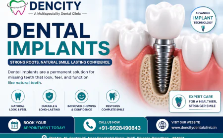 Dental Implant Specialist: Why Expertise Matters for a Healthy and Confident Smile
