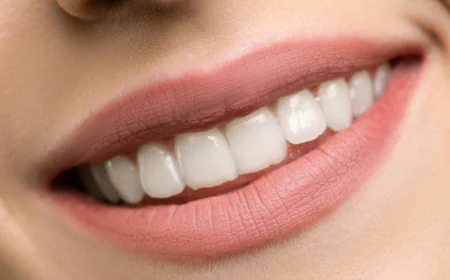 Can Teeth Whitening Make Your Smile Look Brighter?