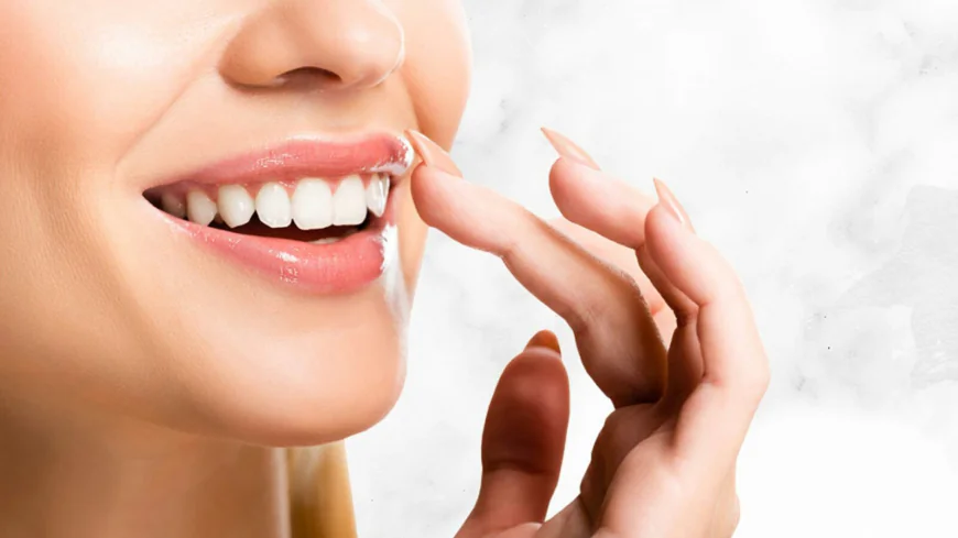Best Dental Veneers in Dubai for Stained Teeth