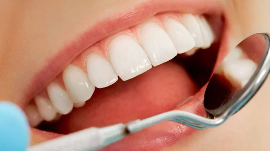 Dental Implants in Dubai vs Dental Bridges