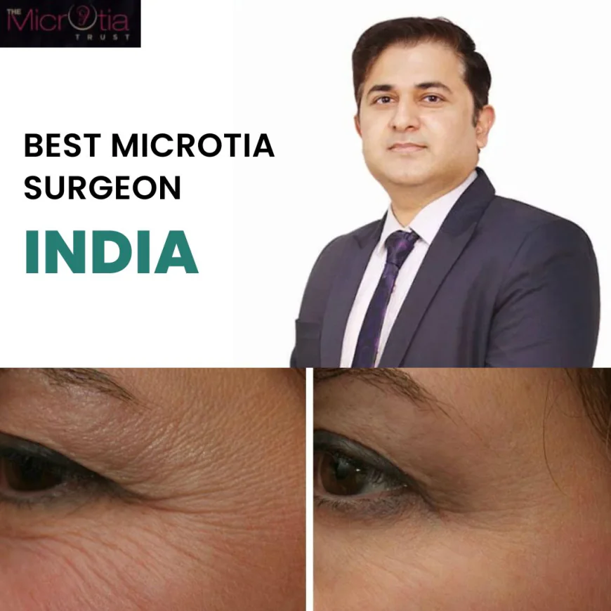 Choosing the Right Path for Microtia Ear Surgery in India