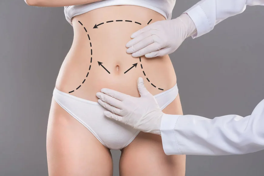 How Liposuction in Islamabad Supports Long-Term Body Shape Stability
