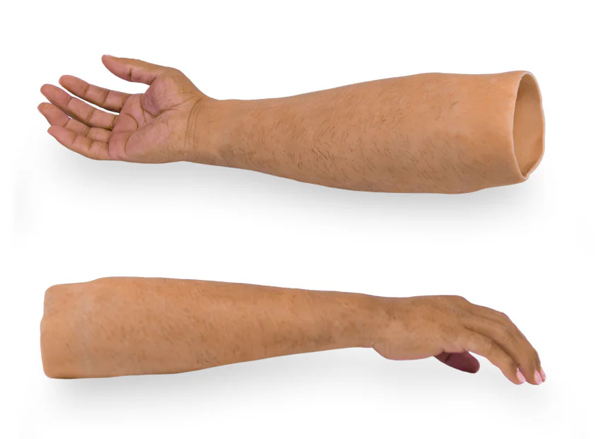 A Complete Guide to Custom Hand Prosthetics After Hand Amputation