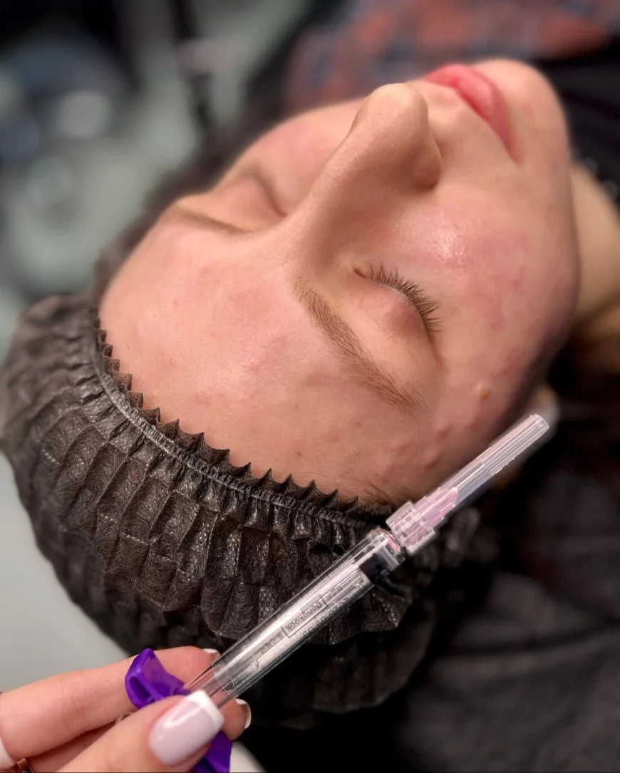 Fillers in Dubai: Transforming Your Look with Confidence
