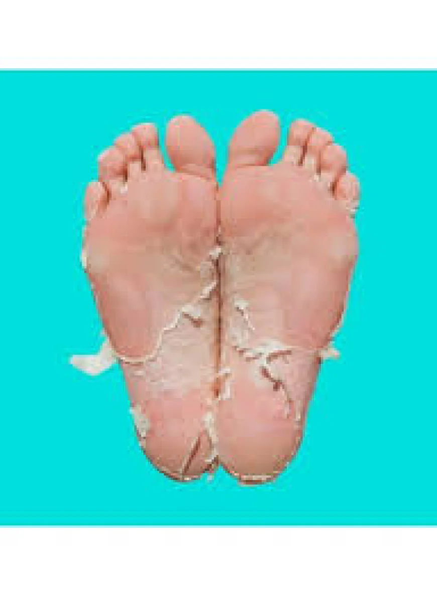 Leg Peel in Dubai for Smooth and Healthy-Looking Legs | Skin Renewal Guide