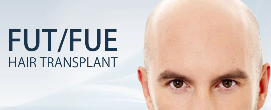 Recovery Tips After Hair Transplant For Week One?
