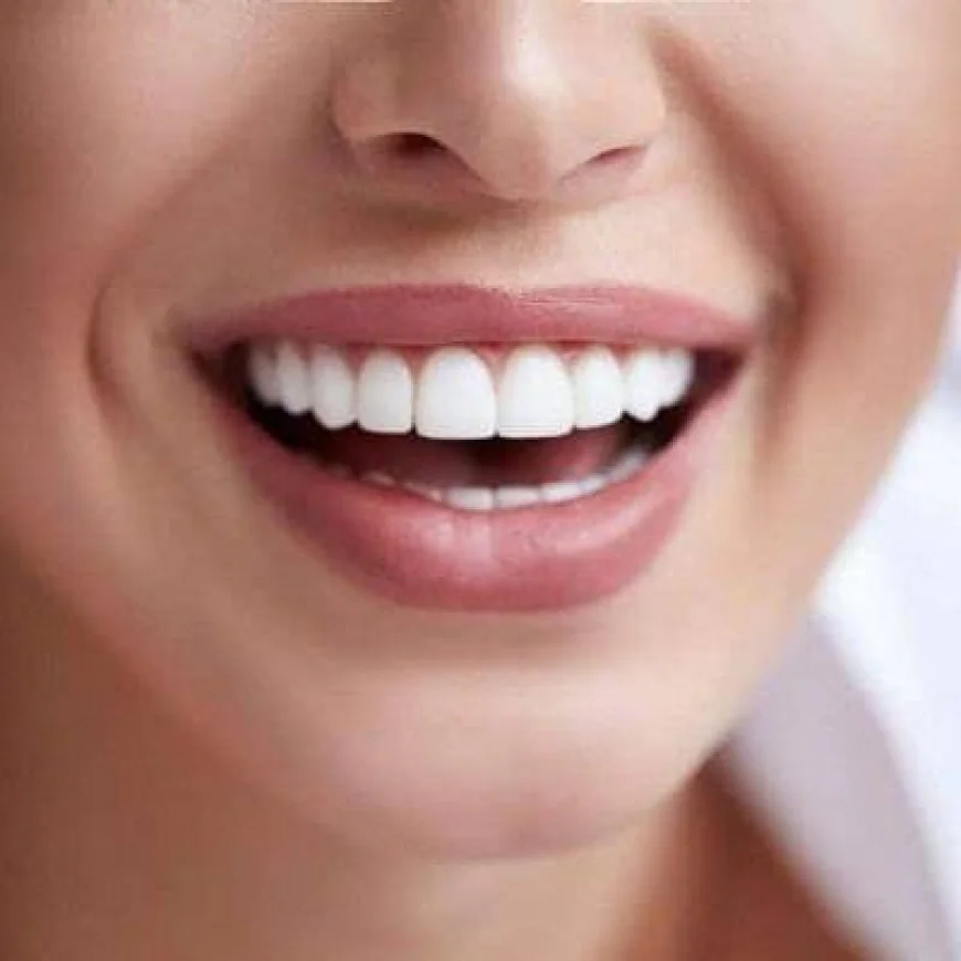 Brighten Your Smile Naturally with Zoom Teeth Whitening in Dubai | Complete Guide