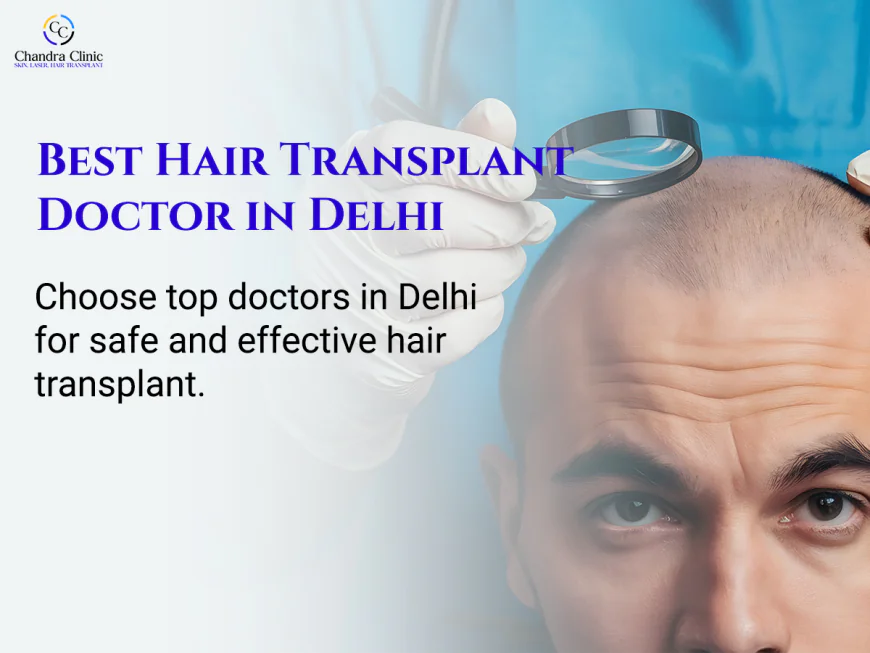 How to Find a Trusted Hair Transplant Doctor in Delhi for Natural Results