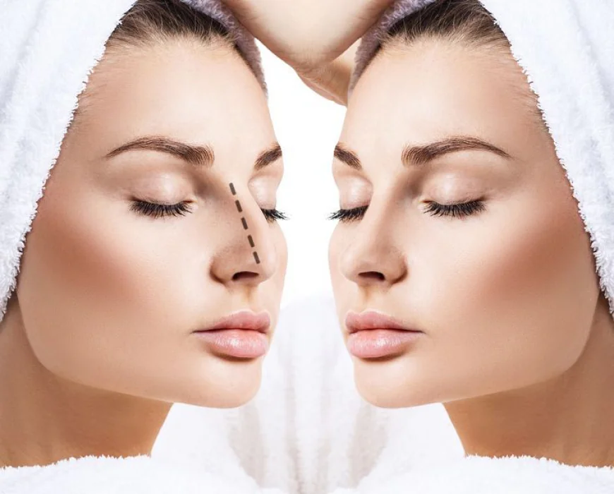 Rhinoplasty in Dubai: Comprehensive Surgical Consultations