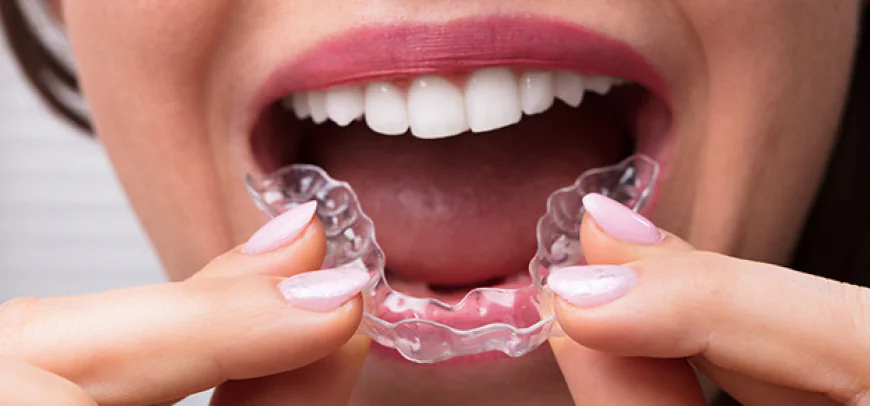 Can Mouth Guards Cause Gum Irritation?