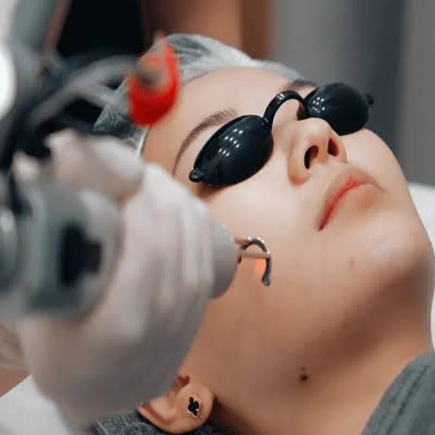Laser Hair Removal for Dark Skin: Safety & Treatment Options