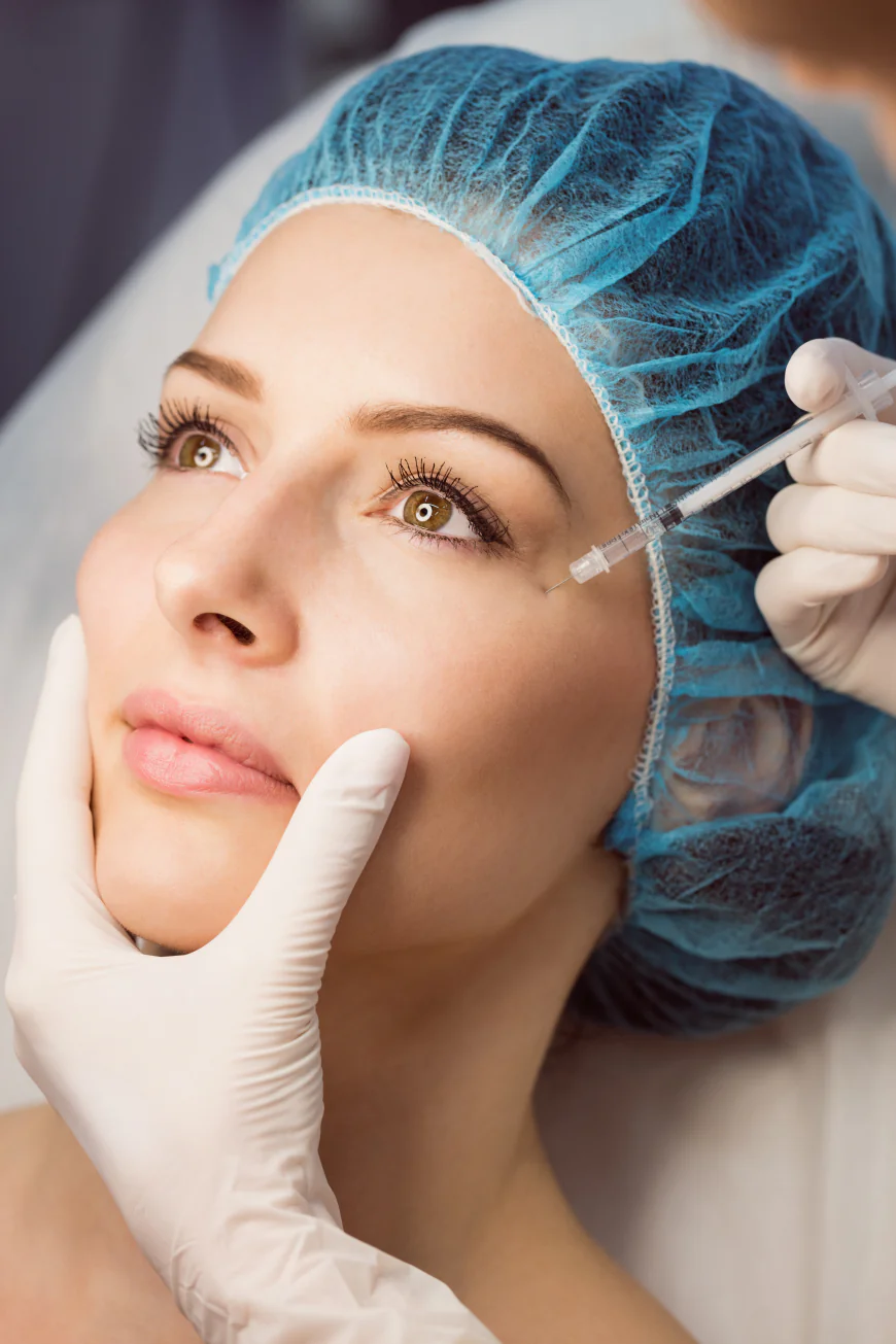 Cosmetic Surgery for Acne Scars in Indore